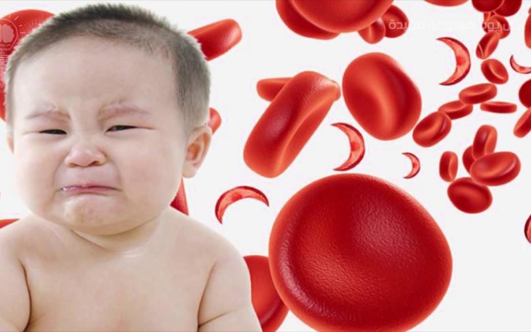 Thiếu máu thiếu sắt ở trẻ: Những điều cần biết và cách phòng ngừa